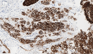 CLDN18染色像（20倍）